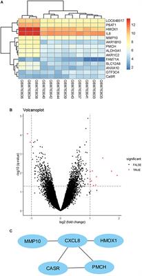 Calcium-Sensing Receptor Participates in High Glucose-Induced EndMT in Primary Human Aortic Endothelial Cells